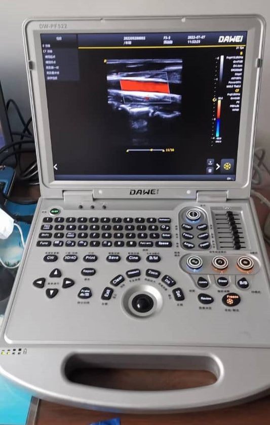 ECHOGRAPHIE PORTABLE COULEUR